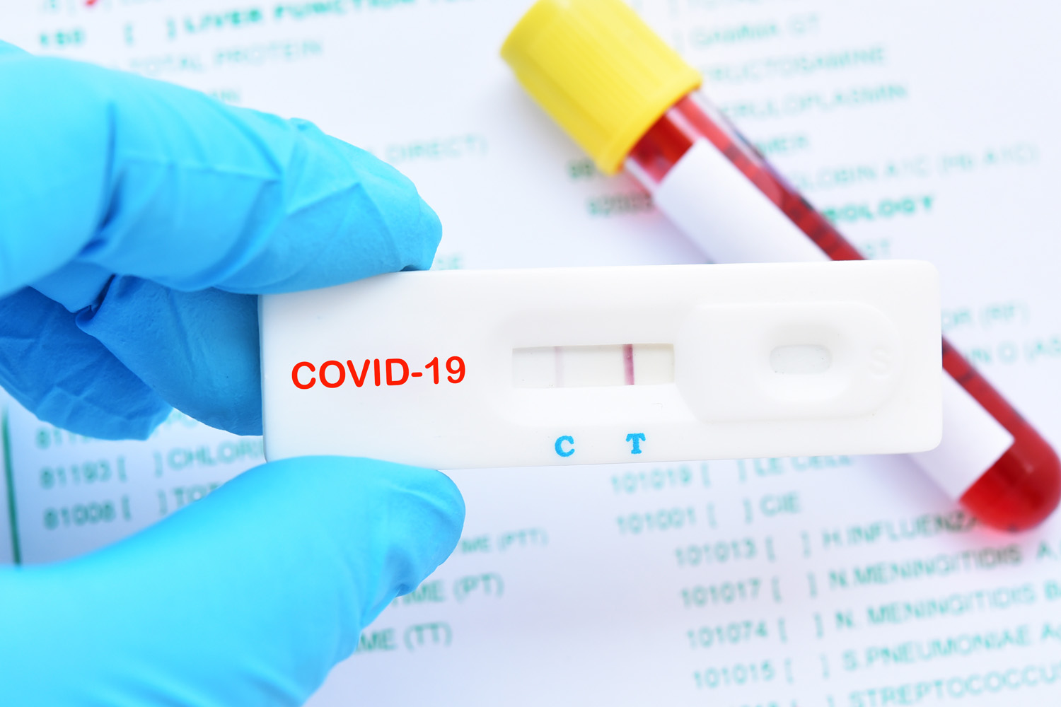 Schlaganfall durch Covid-19?