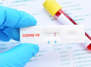 (© <p>Adobe</p>) (© <p>Adobe</p>)