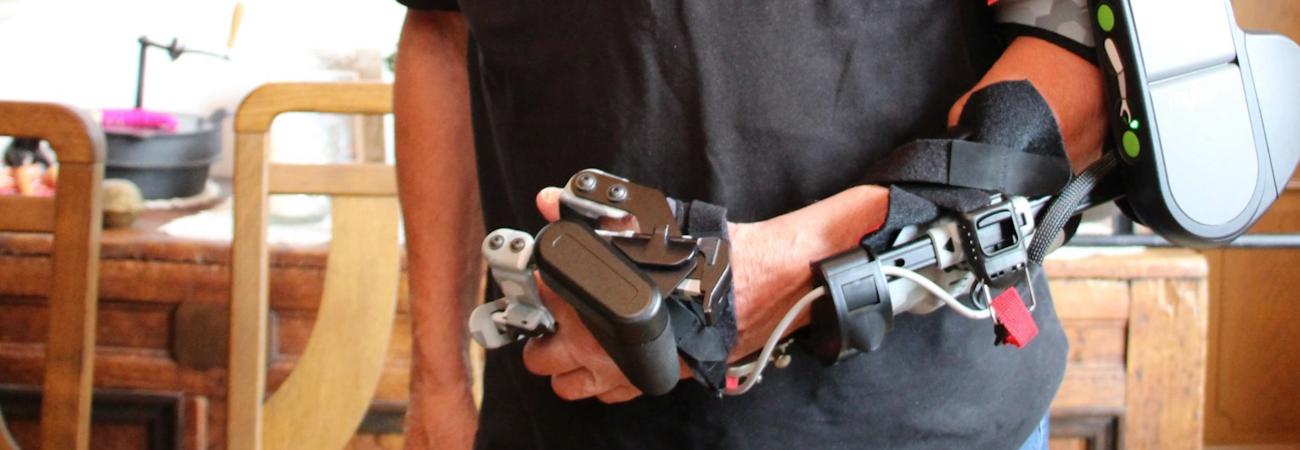 Hightech für den Arm
