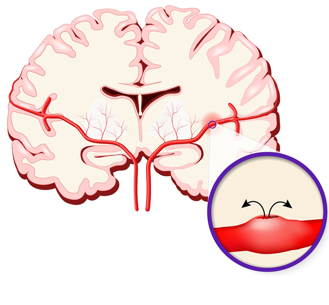 Fotolia