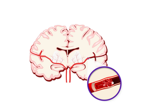 (© Fotolia) (© Fotolia)